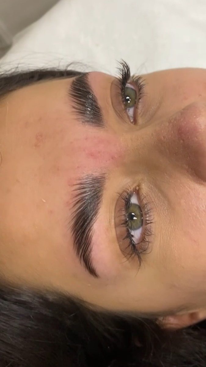  17/20